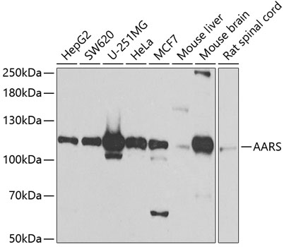 Anti-AARS Antibody (CAB7864)