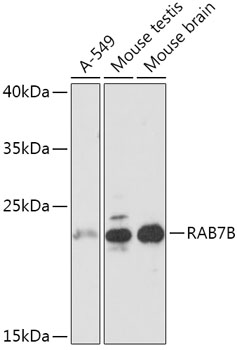 Anti-RAB7B Antibody (CAB17855)