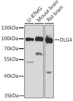 Anti-DLG4 Antibody (CAB7889)