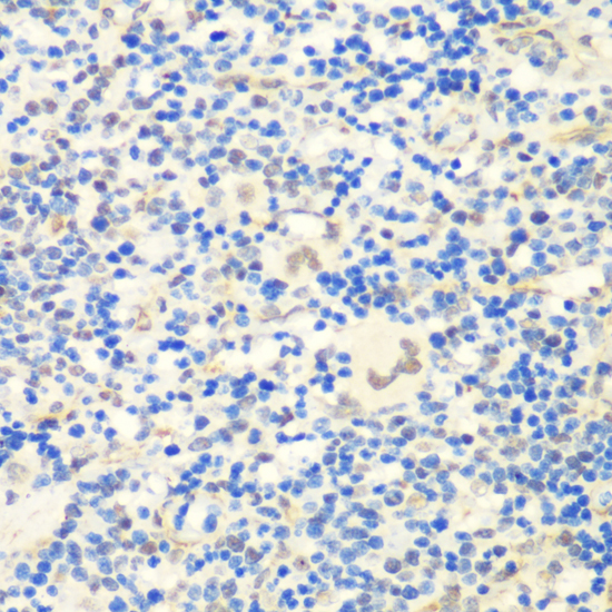 Anti-CTCF Antibody (CAB13272)
