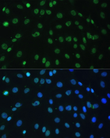 Anti-HNRNPD Antibody (CAB15679)