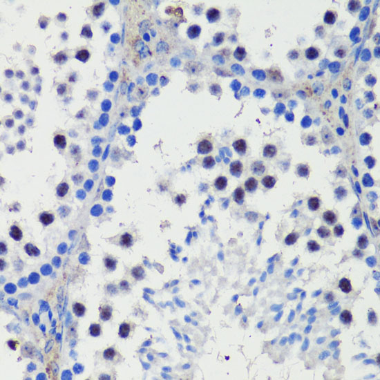 Anti-NOTCH1 Antibody (CAB16673)