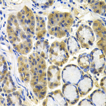 Anti-APBB1 Antibody (CAB1944)