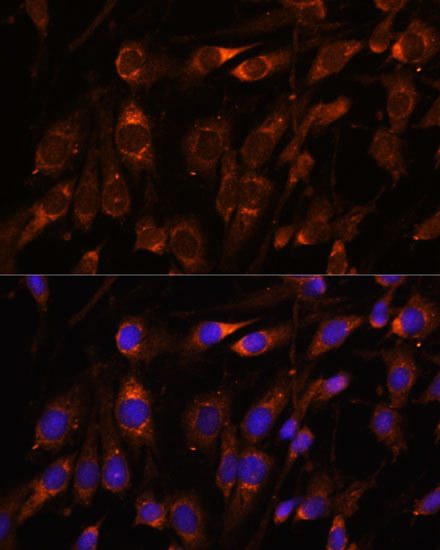 Anti-FARSB Antibody (CAB15375)