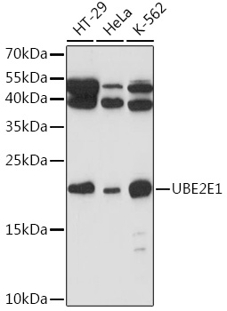 Anti-UBE2E1 Antibody