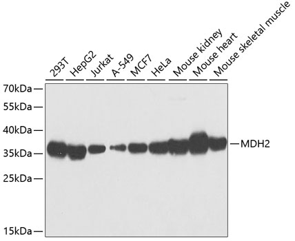 Anti-MDH2 Antibody (CAB13516)