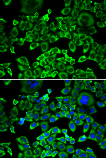 Anti-EIF4B Antibody (CAB5405)