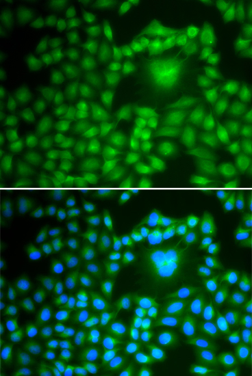 Anti-PPP1CB Antibody (CAB13529)