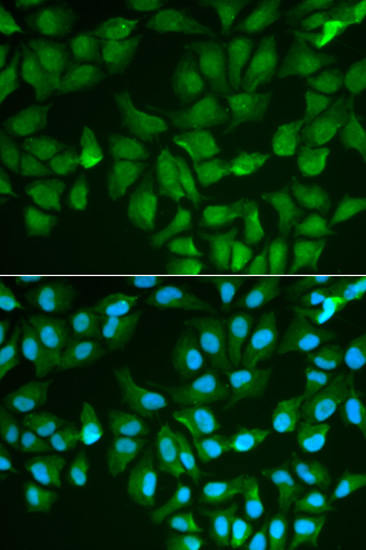 Anti-LGALS3 Antibody (CAB1464)