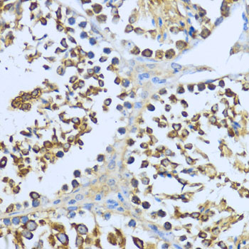Anti-Hsp90 alpha Antibody (CAB12448)
