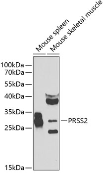 Anti-PRSS2 Antibody (CAB7923)