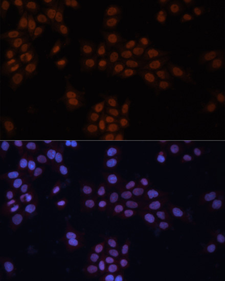 Anti-GTF2I Antibody (CAB12441)