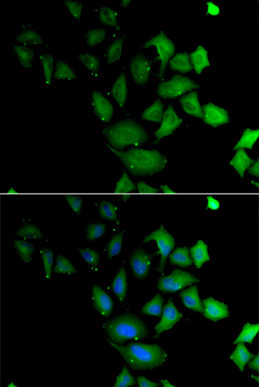 Anti-PSG1 Antibody (CAB13533)