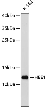 Anti-HBE1 Antibody (CAB3909)