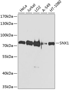 Anti-Sorting nexin-1 Polyclonal Antibody (CAB8625)