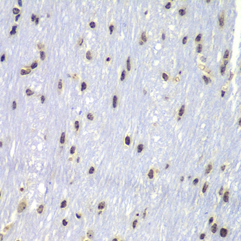 Anti-Lyn Antibody (CAB11385)