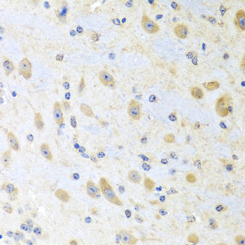 Anti-MLN Antibody (CAB6388)