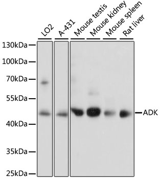 Anti-ADK Antibody (CAB15023)