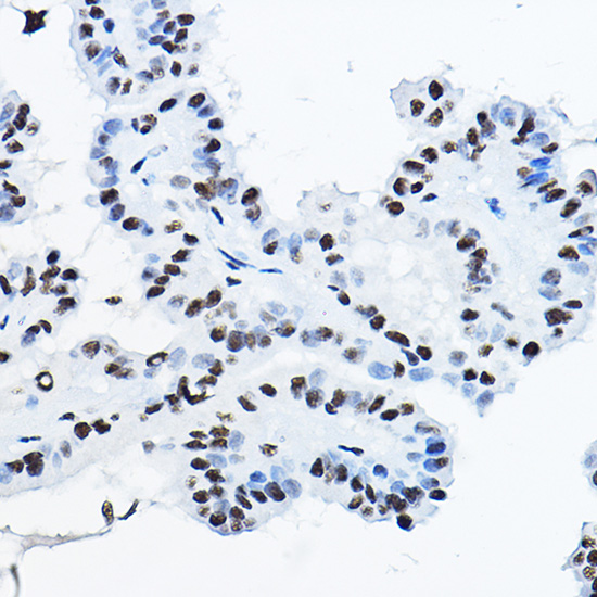 Anti-NONO Antibody (CAB5282)