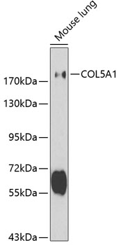 Anti-COL5A1 Antibody (CAB1515)