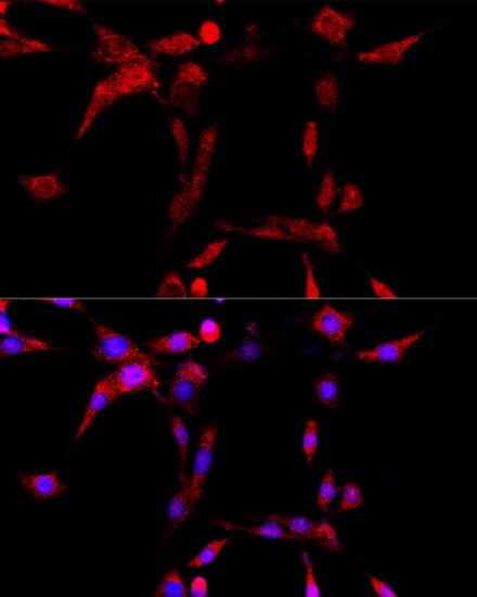 Anti-CYP1B1 Antibody (CAB1377)