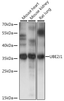 Anti-UBE2J1 Antibody (CAB15841)