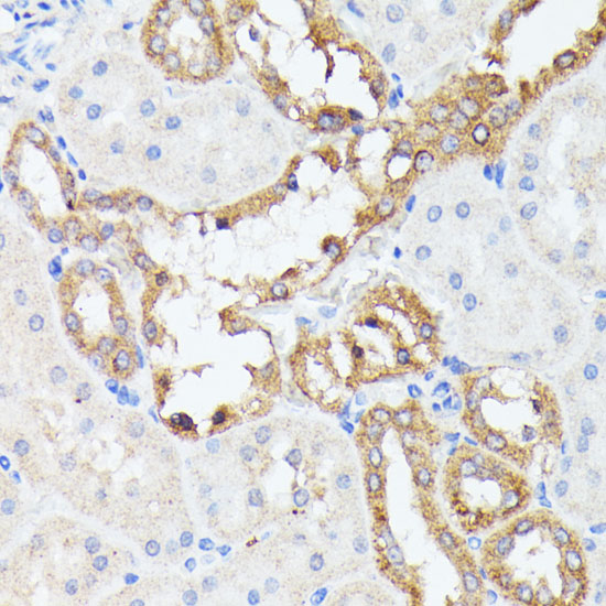 Anti-PTP4A2 Antibody (CAB15335)