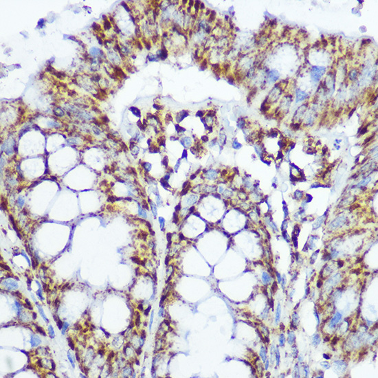 Anti-SOD2 Antibody [KO Validated] (CAB1340)