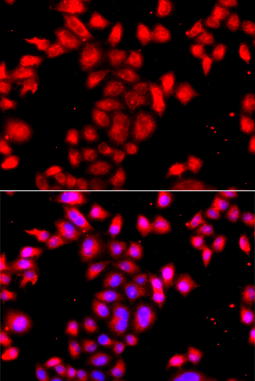 Anti-OSGEPL1 Polyclonal Antibody (CAB8022)