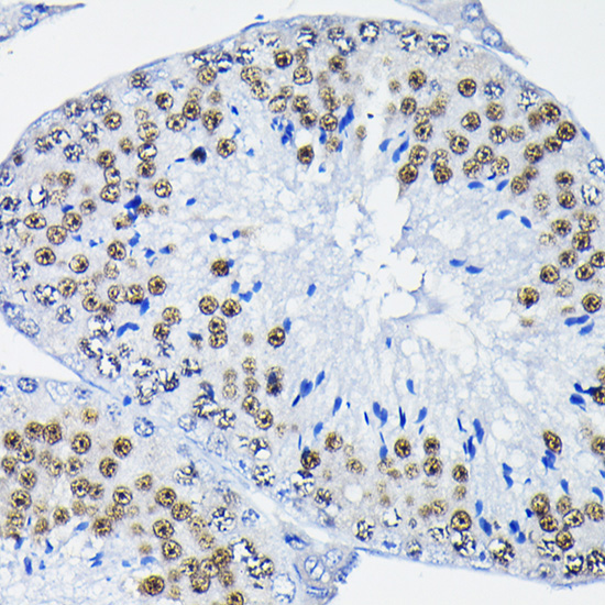 Anti-PTBP2 Antibody (CAB6054)