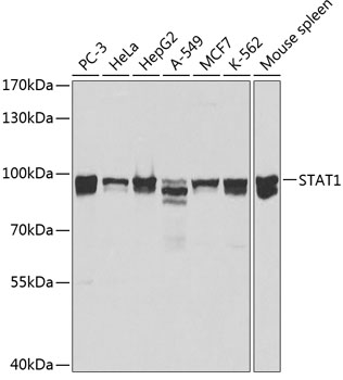 Anti-STAT1 Antibody (CAB0027)