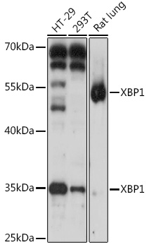 Anti-XBP1 Antibody (CAB1731)