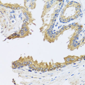 Anti-ARL6 Polyclonal Antibody (CAB8269)