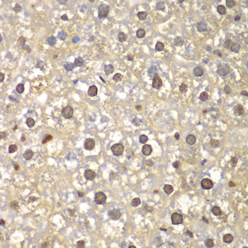 Anti-FEN1 Antibody (CAB1175)