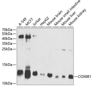 Anti-COX6B1 Antibody (CAB2641)