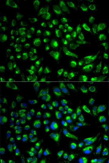 Anti-SPAM1 Antibody (CAB2120)