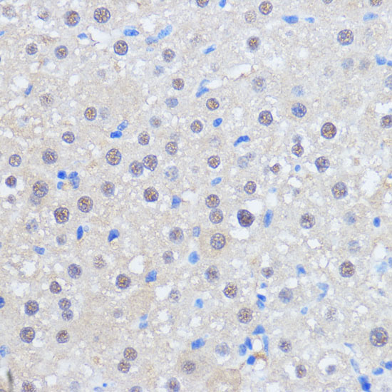 Anti-RBM39 Antibody (CAB15760)