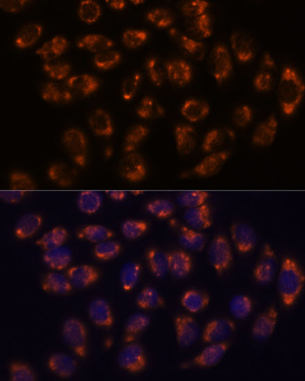 Anti-CRELD1 Antibody (CAB15186)