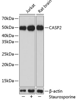 Anti-Caspase-2 Antibody (CAB5724)