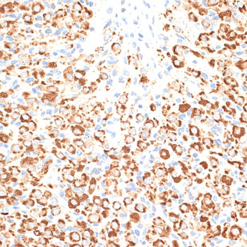 Anti-KLHL9 Antibody (CAB10149)