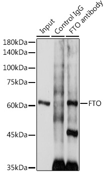 Anti-FTO Antibody (CAB1438)