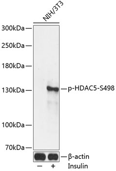 Anti-Phospho-HDAC5-S498 Antibody (CABP0202)