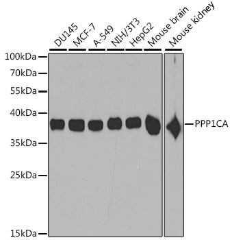 Anti-PPP1CA Antibody (CAB2184)