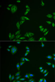 Anti-MLANA Antibody (CAB6290)