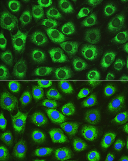 Anti-DNAJC10 Antibody (CAB12143)