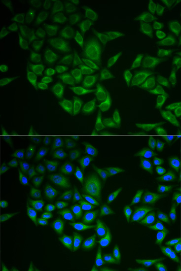 Anti-CD247 Antibody (CAB2058)