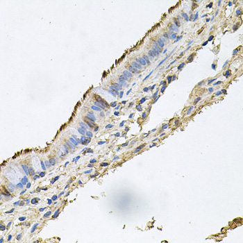 Anti-Desmoglein-1 Polyclonal Antibody (CAB9812)