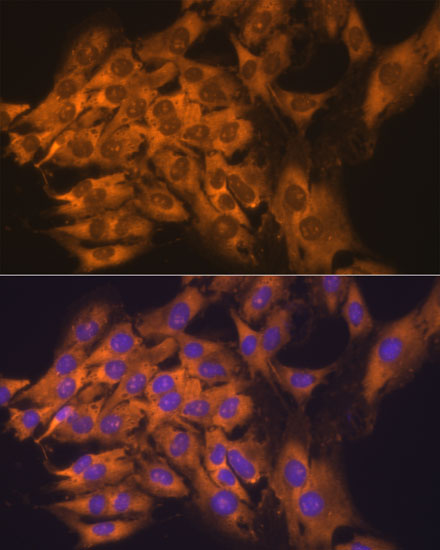 Anti-RPL17 Antibody (CAB5934)