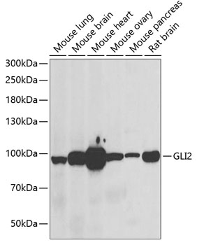 Anti-GLI2 Antibody (CAB6510)