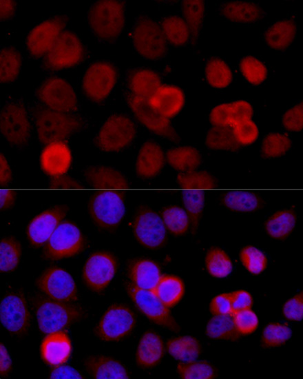 Anti-BAZ1B Polyclonal Antibody [KO Validated] (CAB9851)